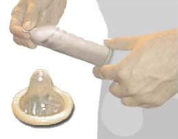La mise en place d’un préservatif