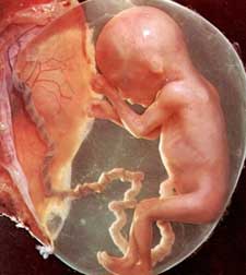 Photo d’un foetus dans un stade avancé