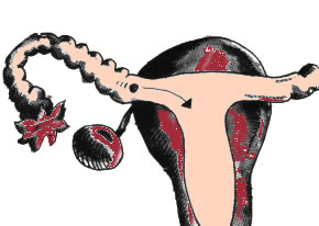 Schéma d’un ovule fécondé se mouvant vers l’utérus