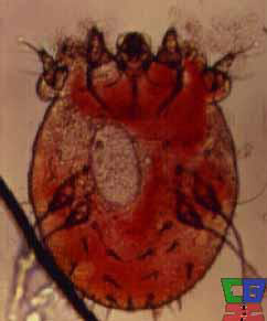La gale vue par microscope