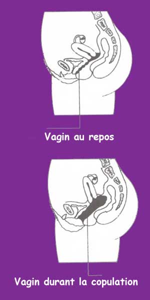 Vaginisme ; schéma du vagin